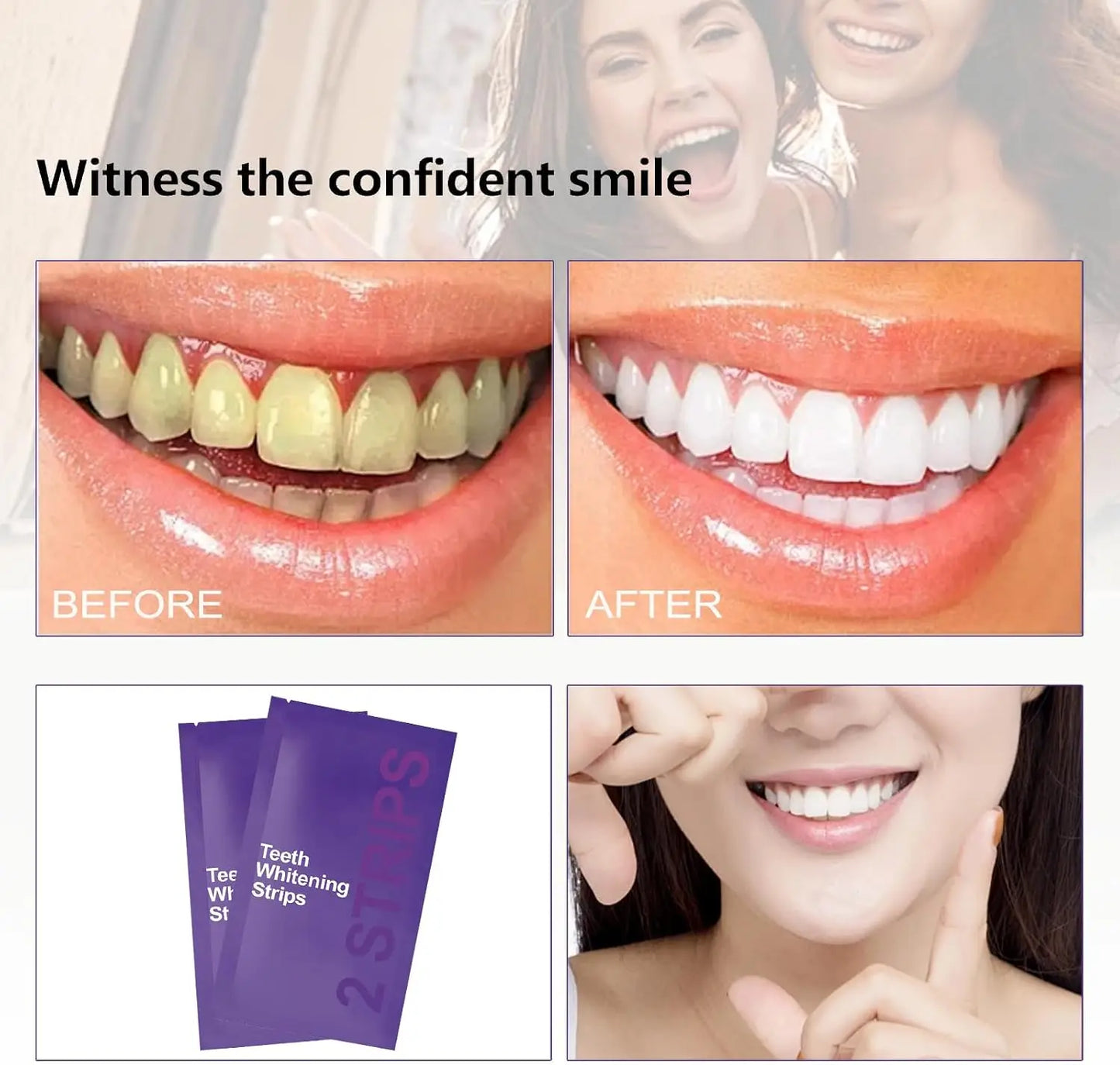 Purple Teeth Whitening Kit