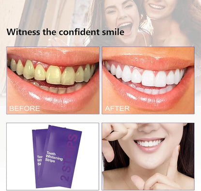 Purple Teeth Whitening Kit